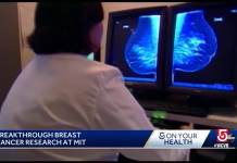 Le MIT développe une IA capable de détecter un cancer du sein 5 ans avant son apparition