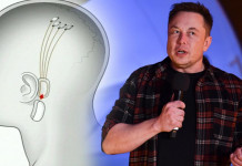 Neuralink, la startup d’Elon Musk, projette d’implanter des puces électroniques dans des cerveaux humains