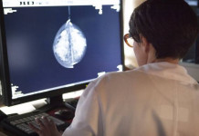 L’IA de Google vient de battre l’Homme pour la détection du cancer du sein